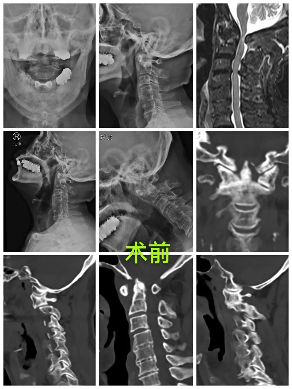圖片關(guān)鍵詞