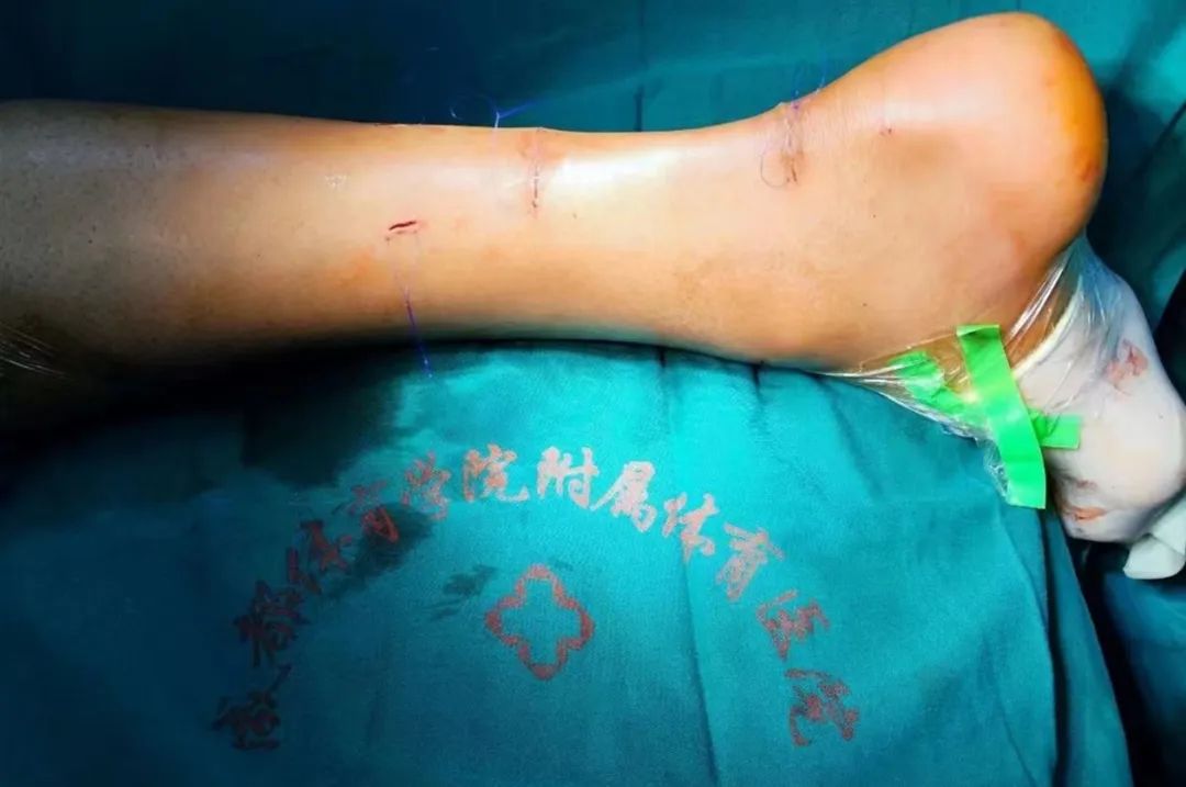 圖片關(guān)鍵詞