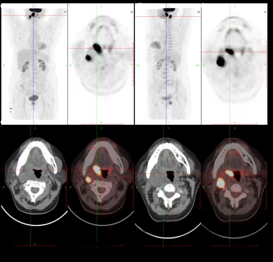 圖片關(guān)鍵詞 圖片關(guān)鍵詞