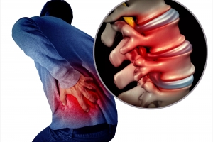 OLIF技術的中國經(jīng)驗