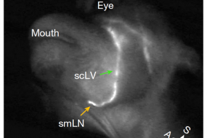 Nature重磅: 頸部按摩就能加速大腦清除垃圾, 預(yù)防老年癡呆重大突破!